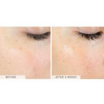 SkinBetter AlphaRet Exfoliating Peel Pads 30 buc. - imagine 6