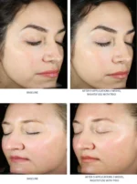 SkinBetter AlphaRet Exfoliating Peel Pads 30 buc. - imagine 8