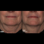 SkinBetter InterFuse Treatment Cream Face and Neck 30ml - imagine 3