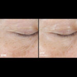 SkinBetter InterFuse Treatment Cream Eye 15ML - imagine 3