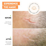 Strataderm, 20 g Gel Siliconic pentru Terapia Profesională a Cicatricilor - imagine 3