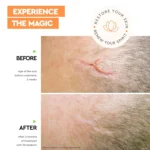 Strataderm, 5 g Gel Siliconic pentru Terapia Profesională a Cicatricilor - imagine 2