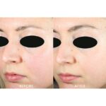 Active Microscrub Teoxane – scrub exfoliant revitalizant - imagine 2